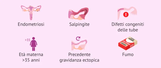 Imagen: Fattori di rischio per la gravidanza fuori dall’utero