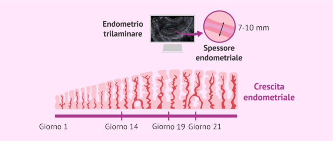 Imagen: Crescita e caratteristiche dell'endometrio per l'impianto