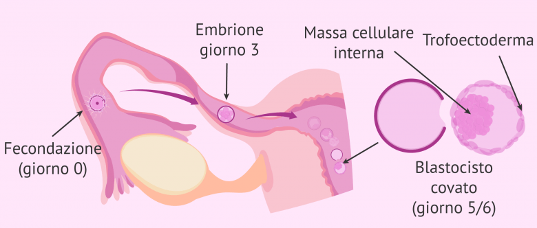 L'embrione Si Impianta A Destra O Sinistra
