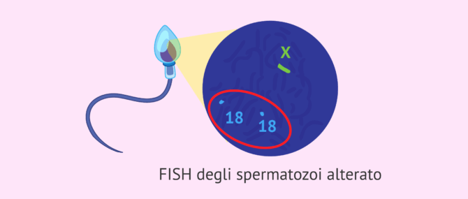 Imagen: FISH degli spermatozoi alterato