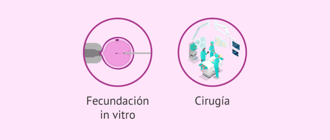 Imagen: Fattore tubarico bilaterale e possibilità di gravidanza