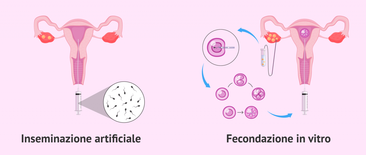 Rapporto Non Protetto 5 Giorni Prima Del Ciclo