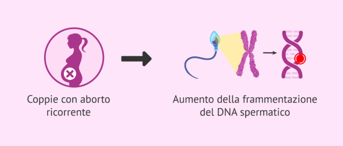 Imagen: Frammentazione del DNA spermatico e aborto ricorrente