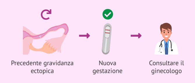 Imagen: Gravidanza dopo una precedente gravidanza ectopica