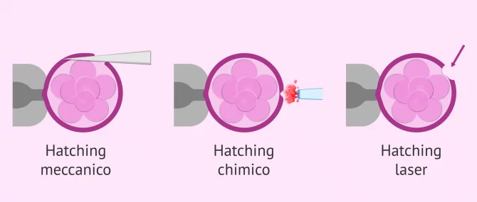 Imagen: Tecniche di tratteggio assistito