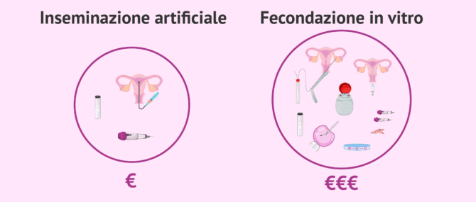 Imagen: Perché il prezzo della FIVET è più alto di quello dell'IA?