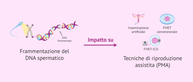 Imagen: Come influisce la frammentazione del DNA spermatico nella riproduzione assistita?