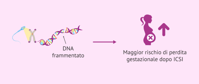 Imagen: Frammentazione del DNA spermatico e rischio di aborto