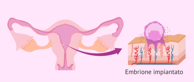 Imagen: Com'è l'impianto embrionale?