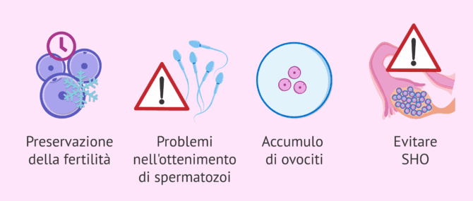Imagen: Quando è raccomandata la FIVET con ovuli congelati?