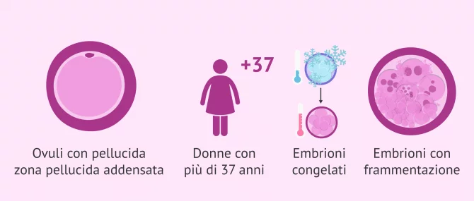 Imagen: Quando è consigliato la cova assistita?