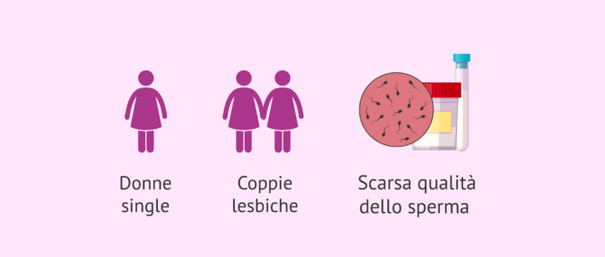 Imagen: Quando viene eseguito il DAI?