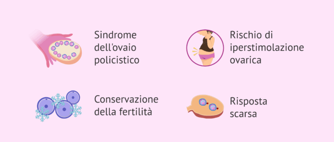 Imagen: Indicazioni per la maturazione in vitro (IVM)