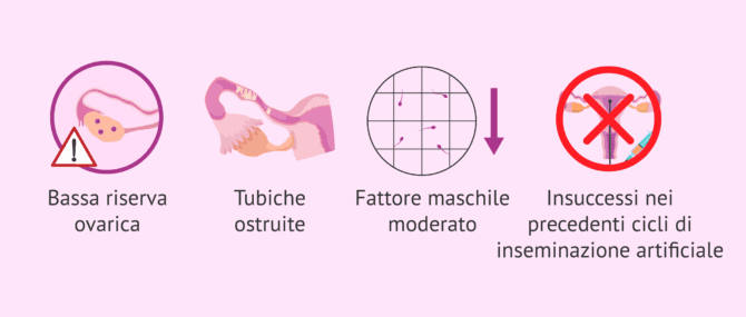 Imagen: Indicazioni per un trattamento di FIVET