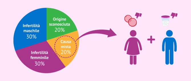 Imagen: A cosa si riferisce la sterilità combinata o mista?