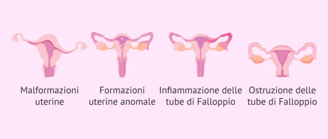 Imagen: Informazioni fornite dall'isterosalpingografia