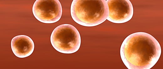 Insufficienza ovarica