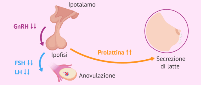 Imagen: Perché l'iperprolattinemia causa infertilità per fattore endocrino?