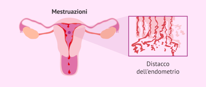 Imagen: Mestruazione: distacco dell'endometrio