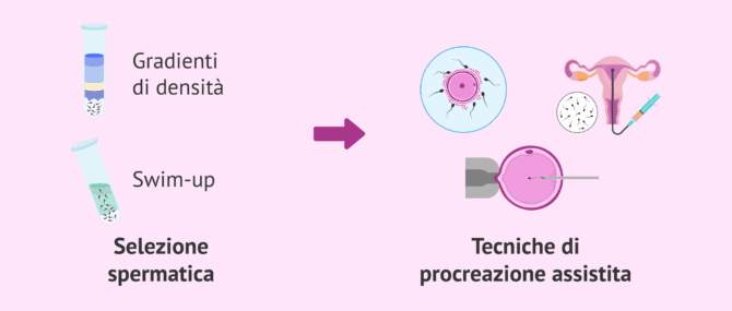 Imagen: Metodi tradizionali di selezione spermatica