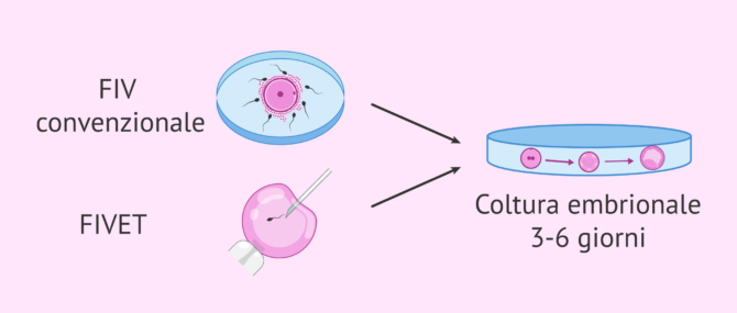 Imagen: Tipi di fecondazione e coltura embrionale