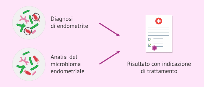 Imagen: Analisi del microbioma endometriale per favorire l'impianto