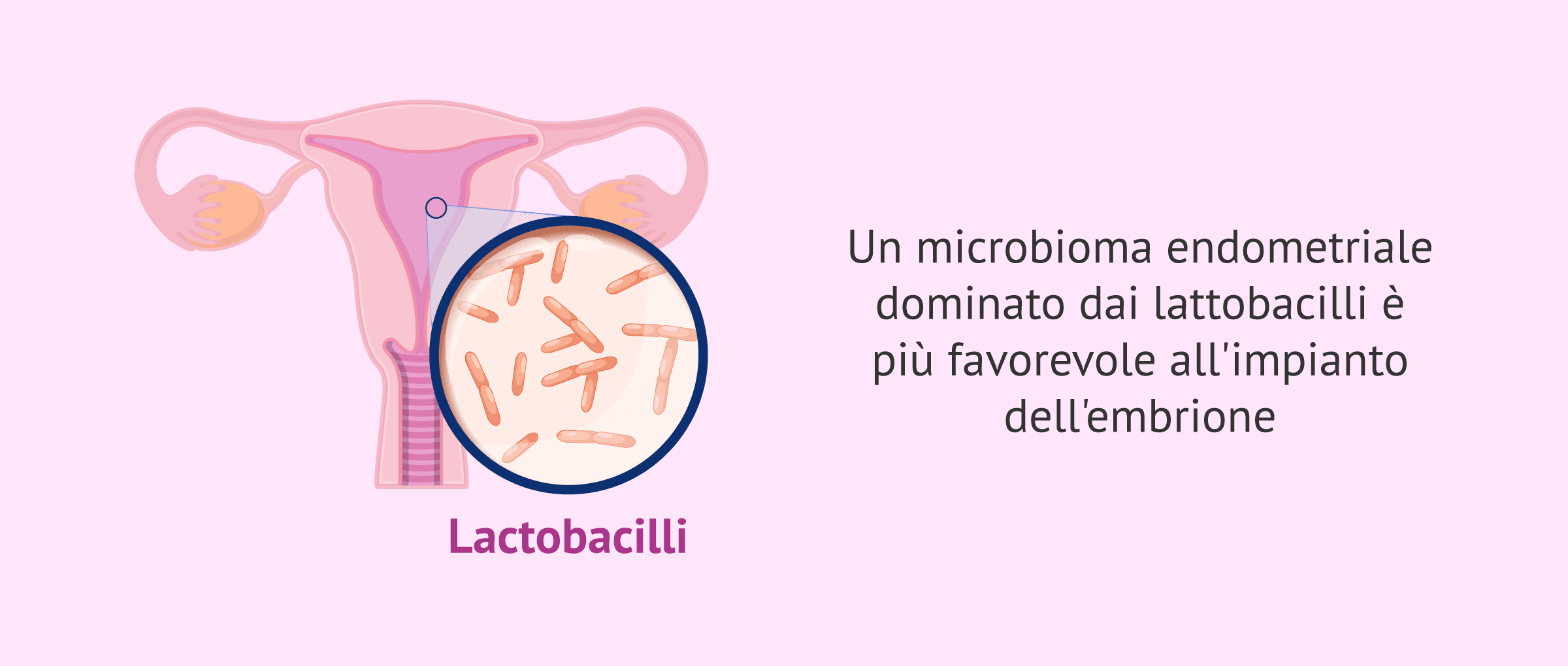 Il microbioma endometriale altera il successo della fecondazione in vitro (IVF)