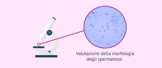 Imagen: Valutare la morfologia degli spermatozoi