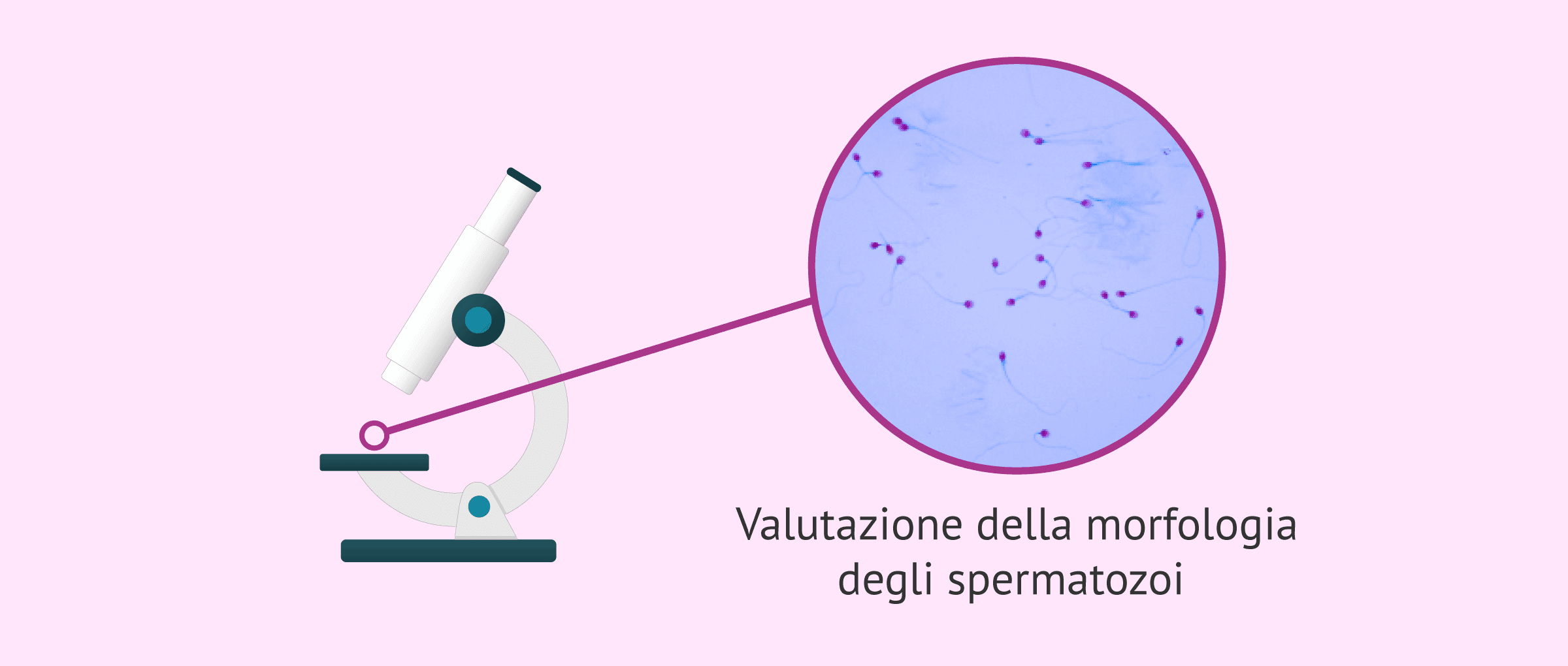 Morfologia spermatica: quali sono i valori normali?
