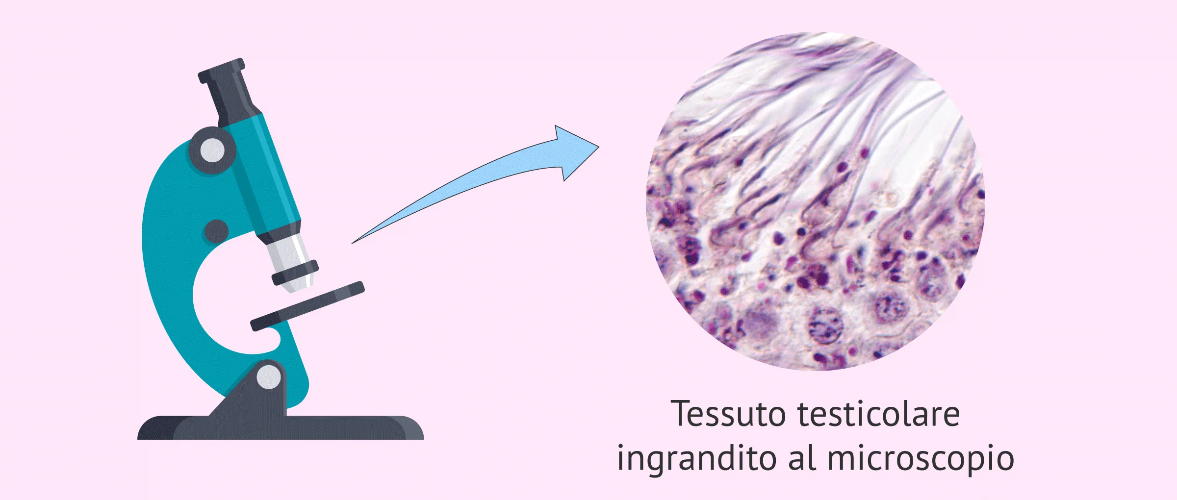 Che cos'è la biopsia testicolare e quando viene eseguita? - Post-operatorio