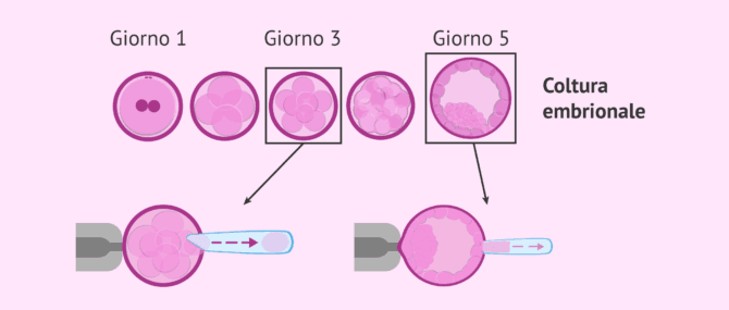 Imagen: Quando si esegue la biopsia embrionale?