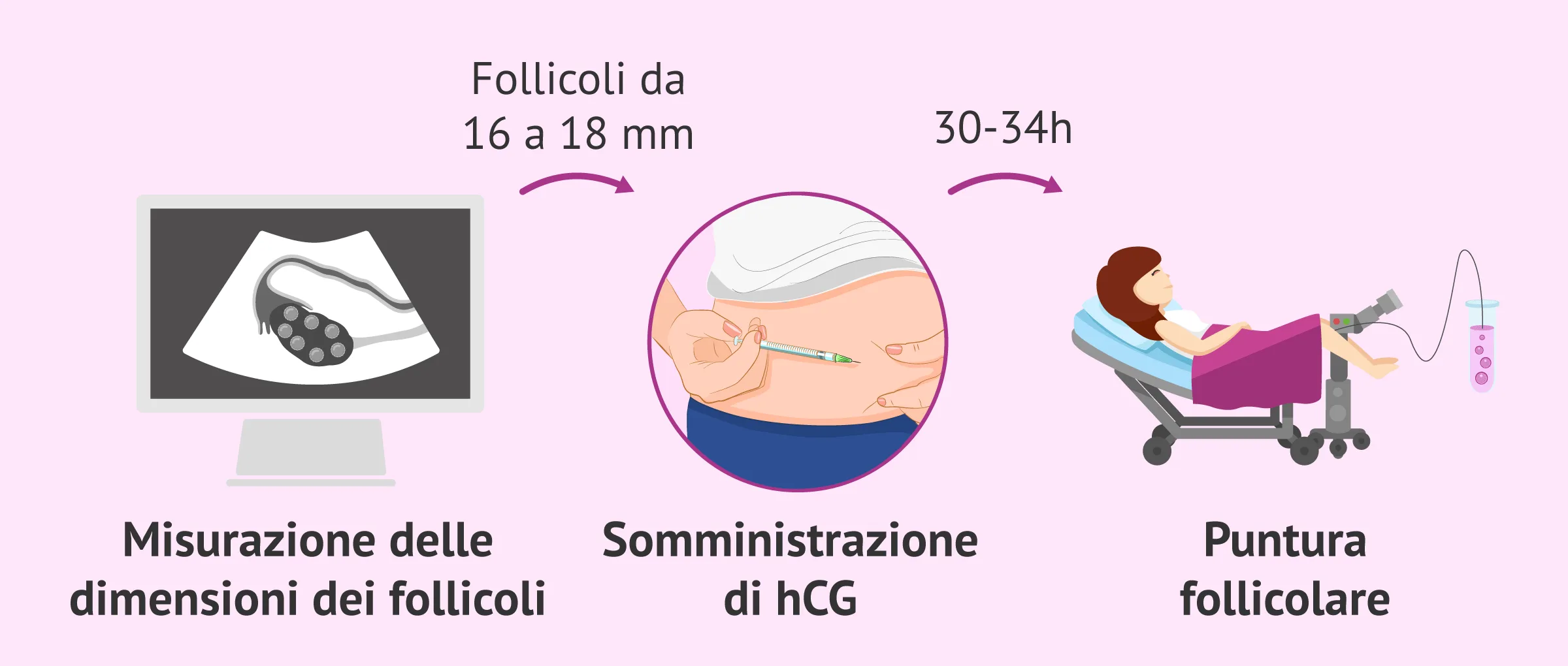 Monitoraggio della stimolazione e programmazione del pick-up ovocitario