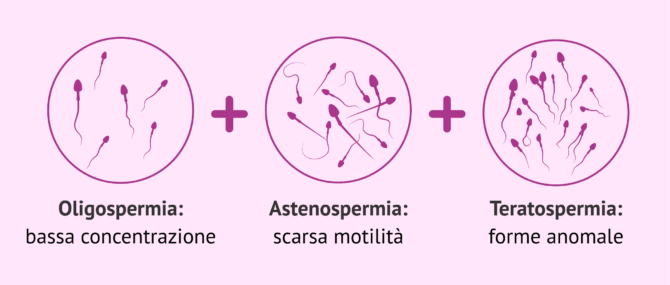 Imagen: Cosa significa oligoastenoteratospermia?