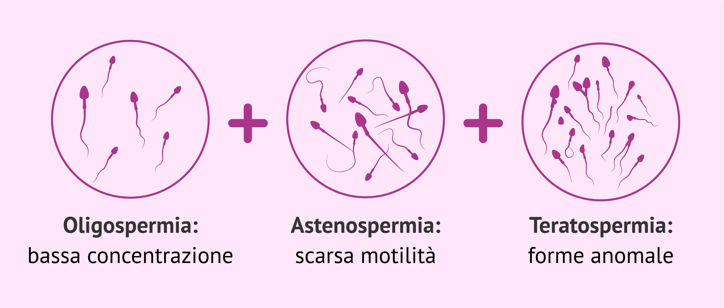 Oligoastenoteratospermia: trattamento e come ottenere una gravidanza