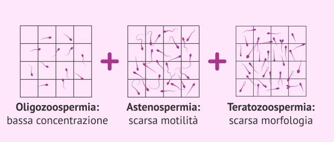 Imagen: Cos'è l'oligoastenoteratozoospermia?-makler