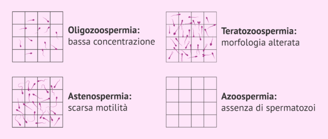Imagen: Alterazioni della qualità seminale