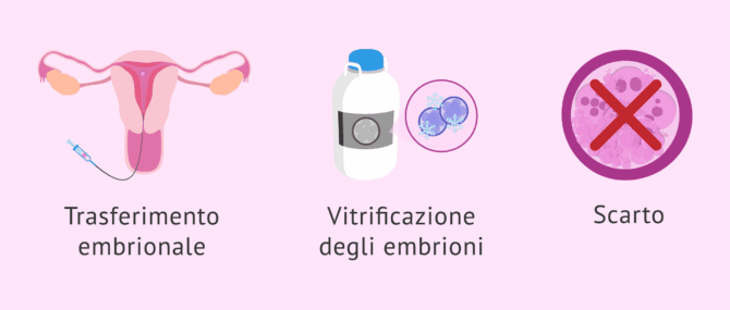 Imagen: Opzioni durante la coltura embrionale