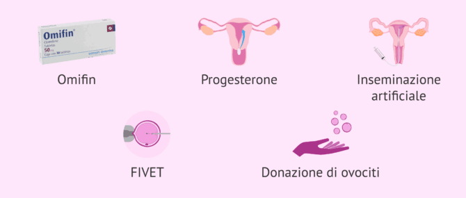 Imagen: Trattamenti per ottenere la gravidanza in donne con infertilità ovarica