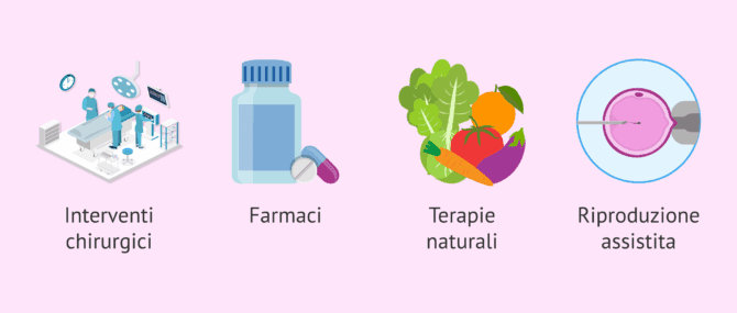 Imagen: Possibili trattamenti dell'oligoastenoteratospermia