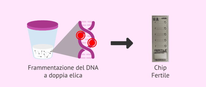 Imagen: Fertile Chip per la frammentazione del DNA spermatico