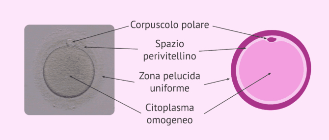 Imagen: Aspetto di un ovocita normale
