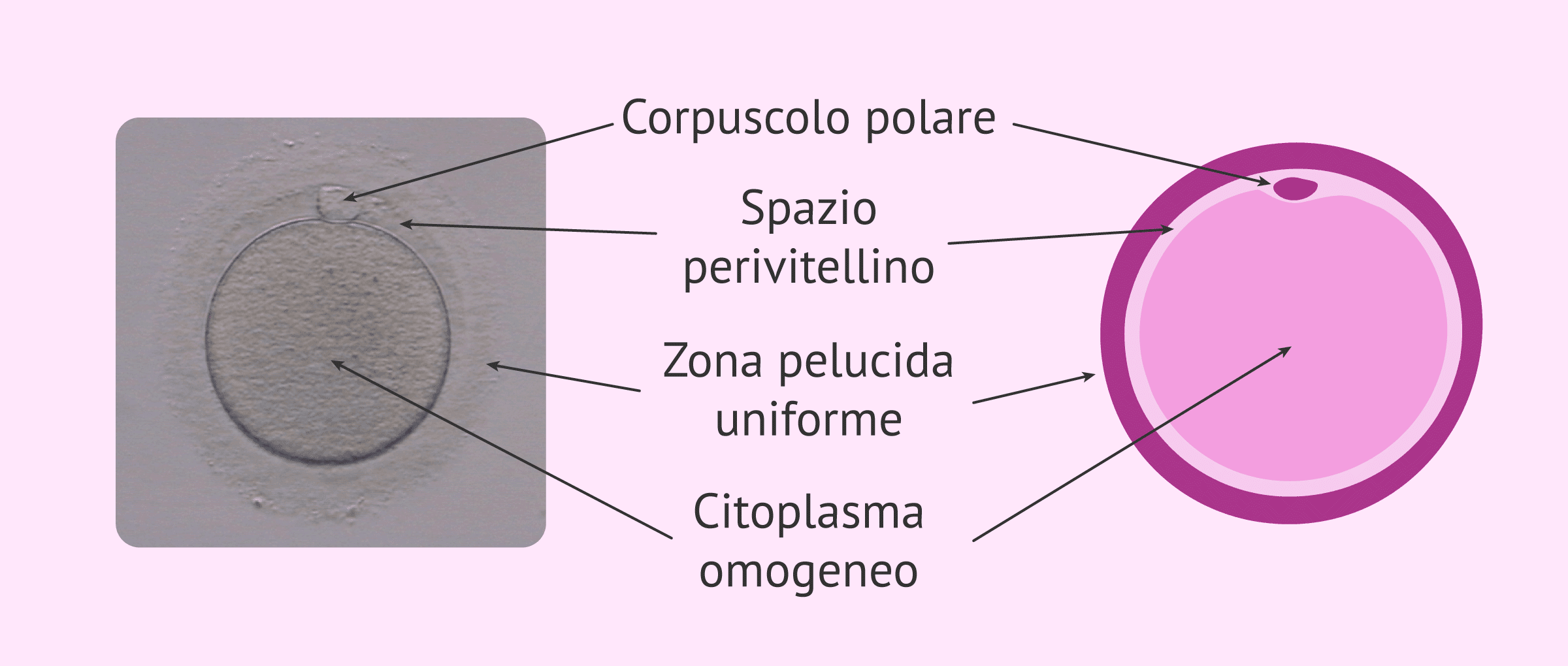 La qualità degli ovuli per un trattamento di FIVET