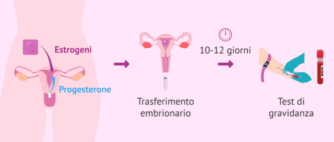 Imagen: Procedura per la ricevente nell’ovodonazione