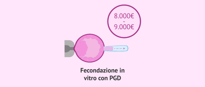 Imagen: Qual è il prezzo della DGP o PGT?