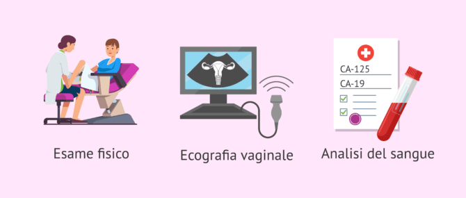 Imagen: Test iniziali per l'endometriosi