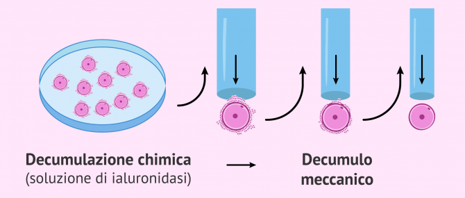 Imagen: Decumulazione degli ovociti