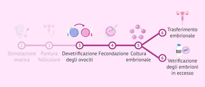 Imagen: Passo dopo passo della FIVET con ovuli vitrificati