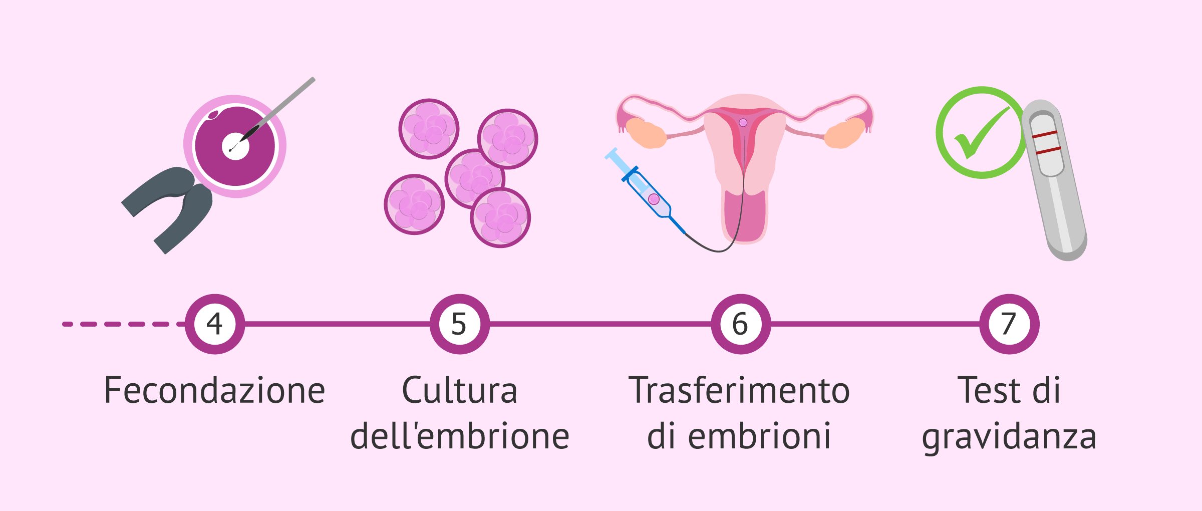 Processo FIVET dalla fecondazione in vitro al trasferimento embrionale