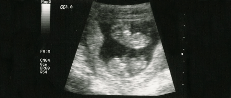 Diagnosi e trattamento