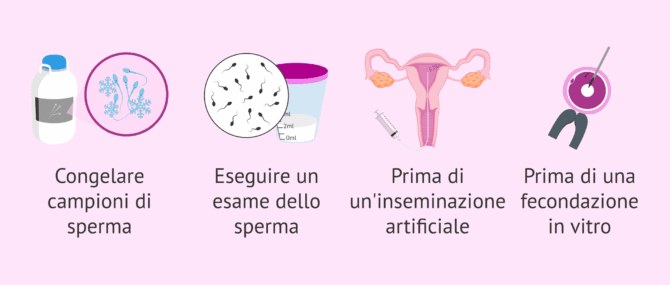 Imagen: Quando è raccomandato un periodo di astinenza?